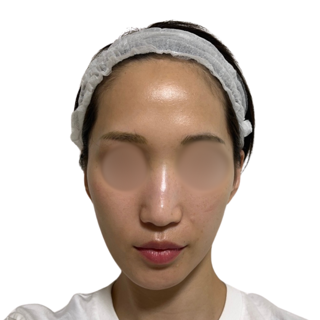 パーティーリフト（スマスアップネオ）